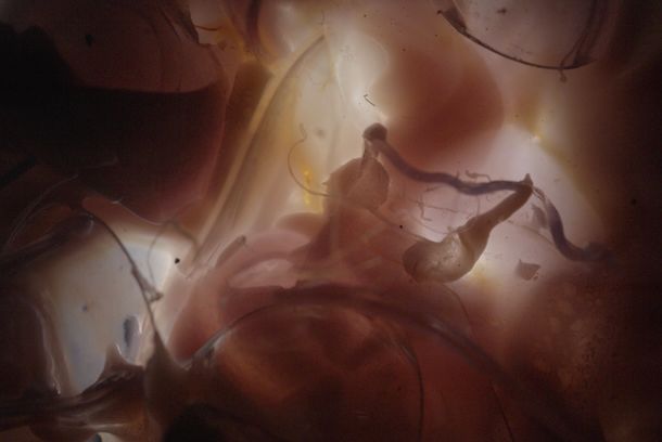 still / picture for Ventricule