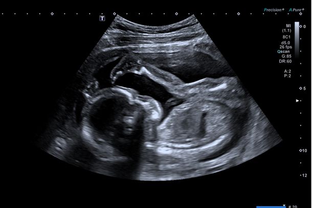 still / picture for Incarnation