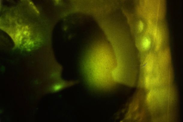 still / picture for Ruins of anticipation