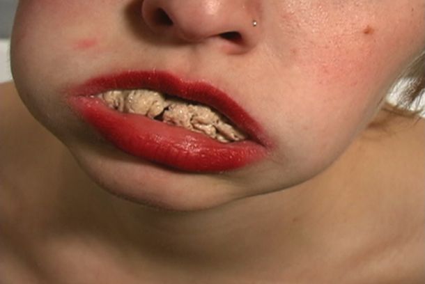still / picture for Teeth in the Wrong Places