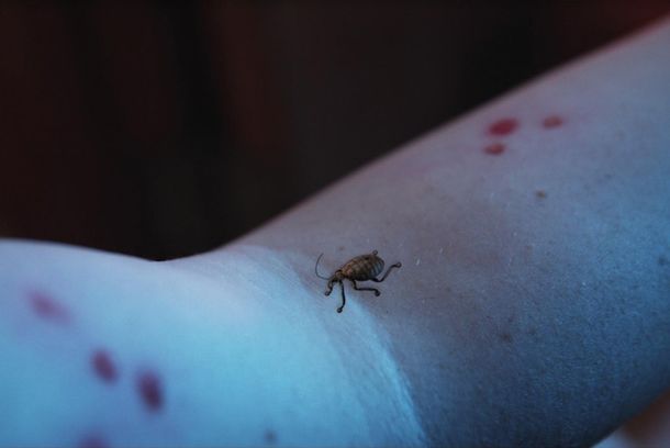 still / picture for Bug Bite