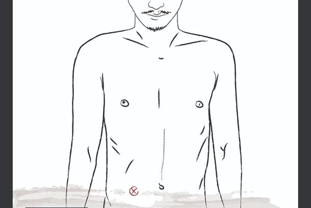 still / picture for 造口人